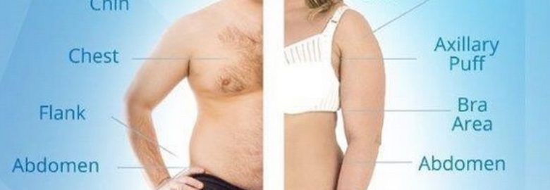 CoolSculpting Center of NYC